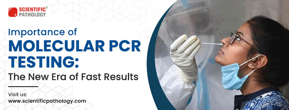 Importance of Molecular PCR Testing: The New Era of Fast Results